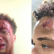 Image for article titled College Student Says He Was Attacked by Cops for Skateboarding Because ... Someone Could Get Hurt, You Know